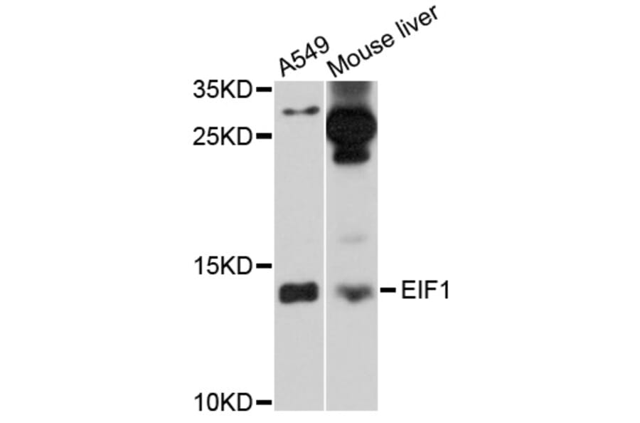 Western Blot - Anti-EIF1 Antibody (A10785) - Antibodies.com
