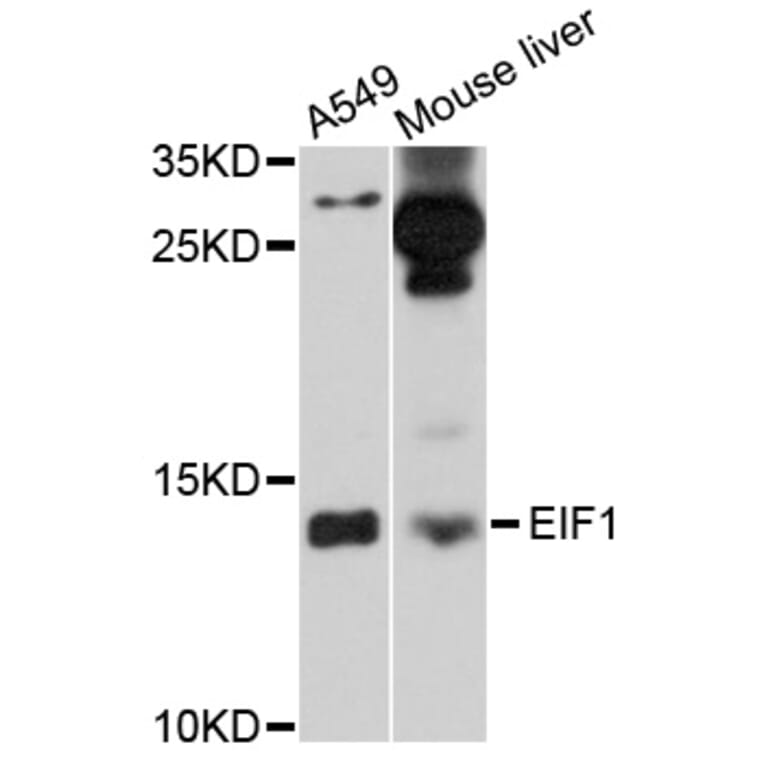 Western Blot - Anti-EIF1 Antibody (A10785) - Antibodies.com