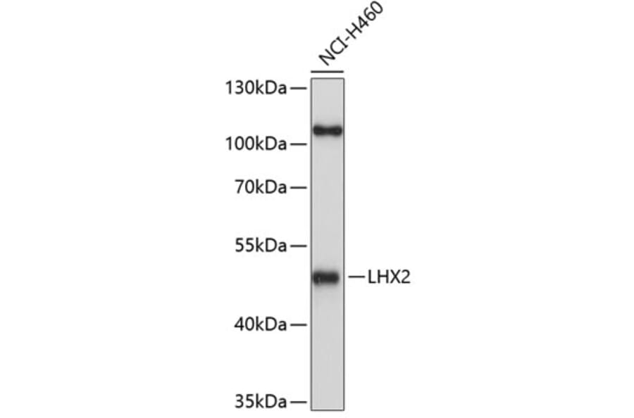 Western Blot - Anti-Lhx2/LH2 Antibody (A11357) - Antibodies.com