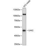 Western Blot - Anti-Lhx2/LH2 Antibody (A11357) - Antibodies.com