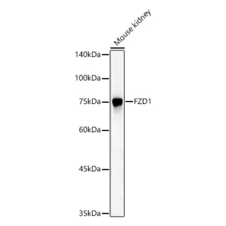 Western Blot - Anti-Frizzled homolog 1 Antibody (A11359) - Antibodies.com