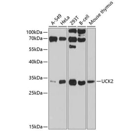 Western Blot - Anti-UCK2 Antibody (A11360) - Antibodies.com