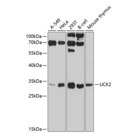 Western Blot - Anti-UCK2 Antibody (A11360) - Antibodies.com