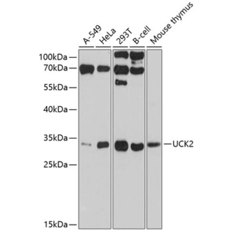 Western Blot - Anti-UCK2 Antibody (A11360) - Antibodies.com
