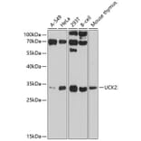 Western Blot - Anti-UCK2 Antibody (A11360) - Antibodies.com