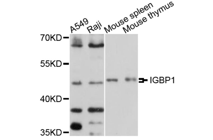 Western Blot - Anti-IGBP1 Antibody (A10836) - Antibodies.com