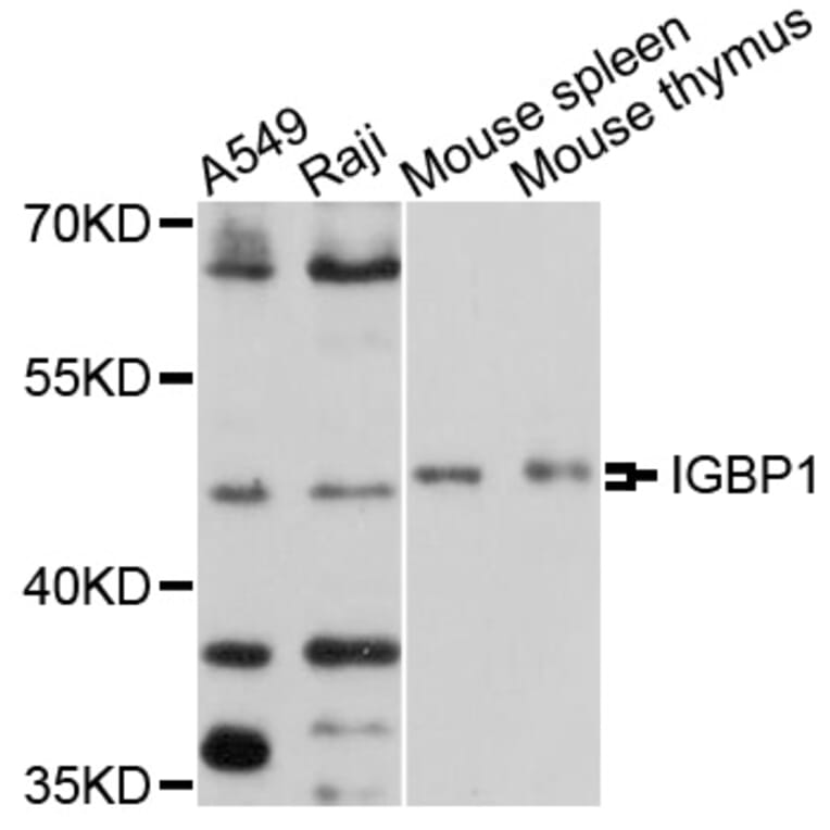 Western Blot - Anti-IGBP1 Antibody (A10836) - Antibodies.com