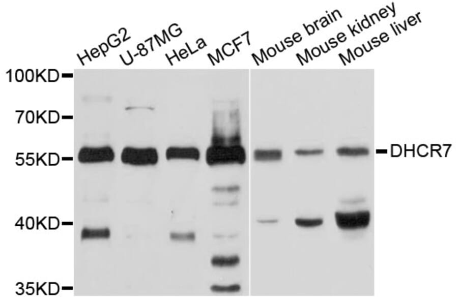 Western Blot - Anti-DHCR7 Antibody (A10860) - Antibodies.com