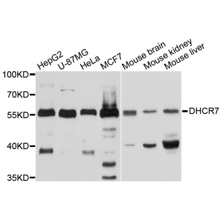 Western Blot - Anti-DHCR7 Antibody (A10860) - Antibodies.com