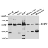 Western Blot - Anti-DHCR7 Antibody (A10860) - Antibodies.com