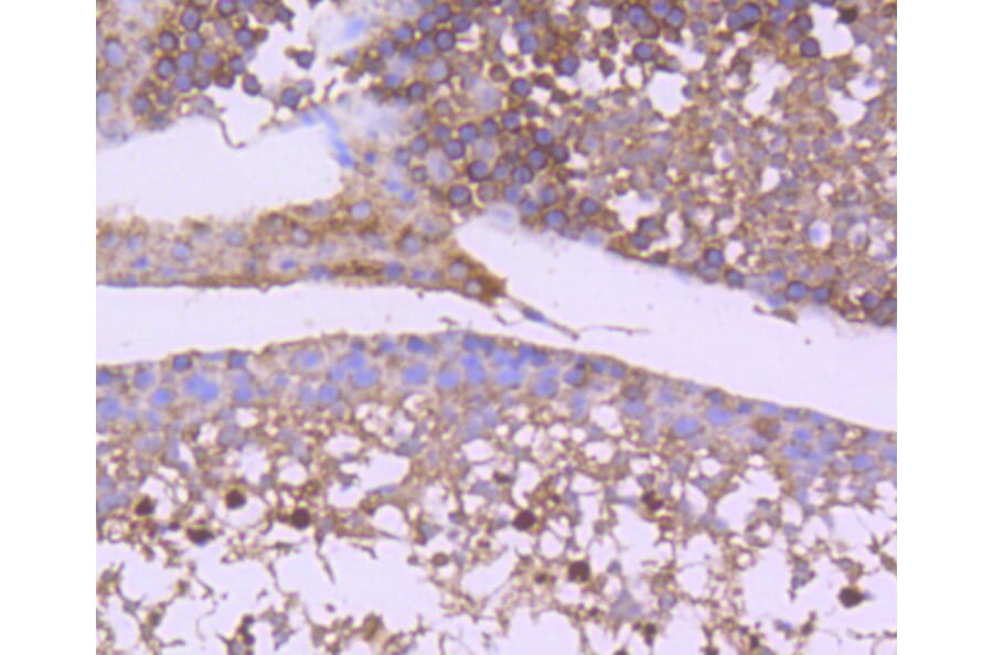 Immunohistochemistry - Anti-GSK3B Antibody (A10877) - Antibodies.com