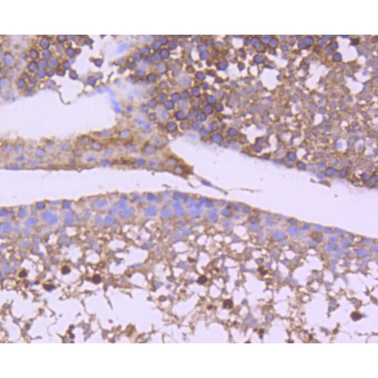 Immunohistochemistry - Anti-GSK3B Antibody (A10877) - Antibodies.com