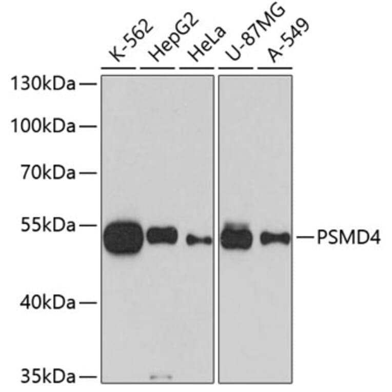 Western Blot - Anti-PSMD4 Antibody (A10887) - Antibodies.com