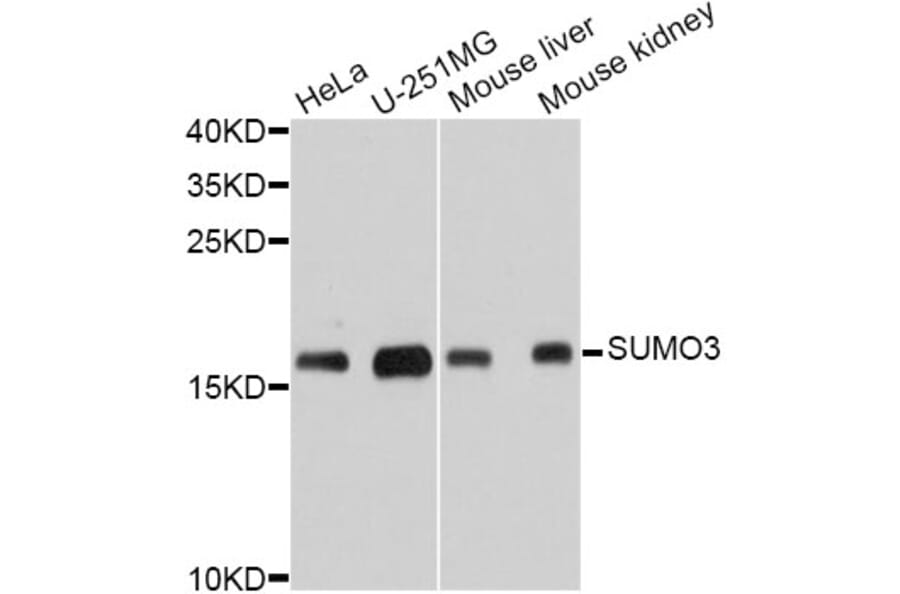 Western Blot - Anti-SUMO3 Antibody (A10896) - Antibodies.com