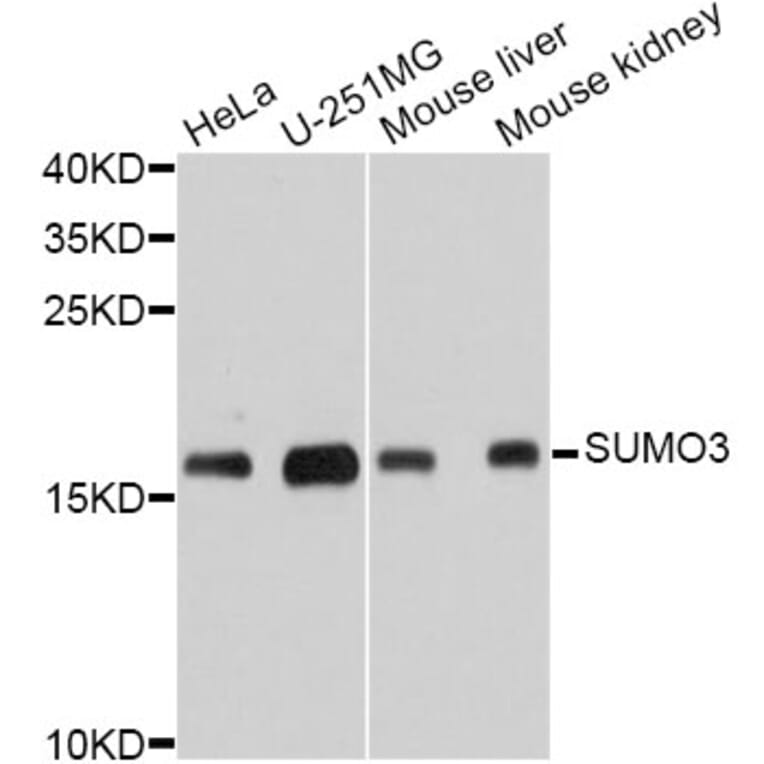 Western Blot - Anti-SUMO3 Antibody (A10896) - Antibodies.com