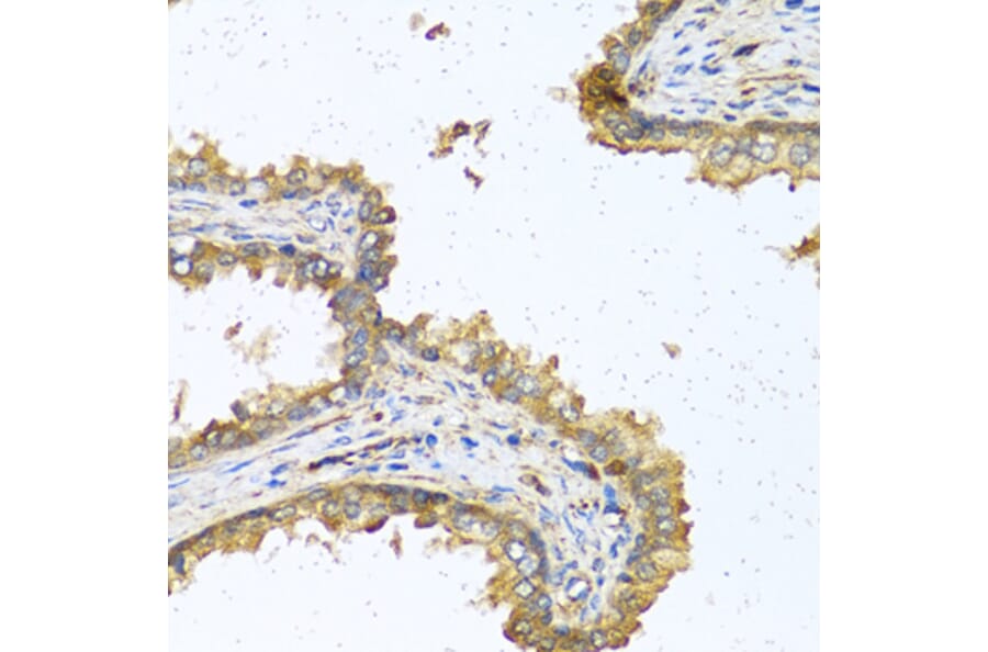 Immunohistochemistry - Anti-RNASE11 Antibody (A1091) - Antibodies.com