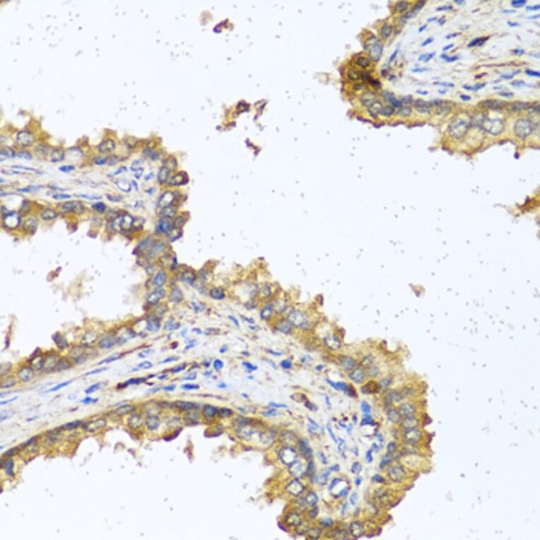 Immunohistochemistry - Anti-RNASE11 Antibody (A1091) - Antibodies.com