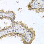 Immunohistochemistry - Anti-RNASE11 Antibody (A1091) - Antibodies.com