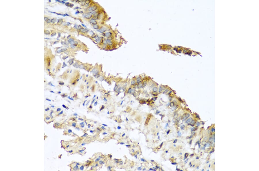 Immunohistochemistry - Anti-RNASE11 Antibody (A1091) - Antibodies.com