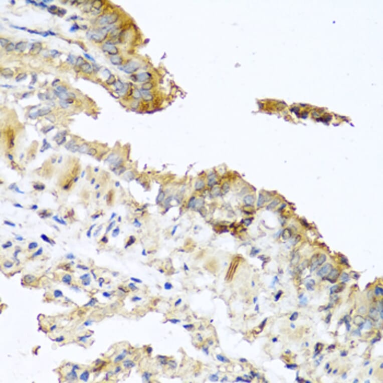 Immunohistochemistry - Anti-RNASE11 Antibody (A1091) - Antibodies.com