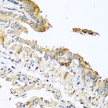 Immunohistochemistry - Anti-RNASE11 Antibody (A1091) - Antibodies.com