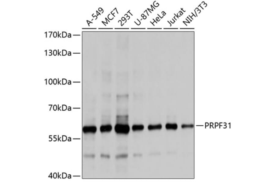 Western Blot - Anti-PRPF31 Antibody (A10920) - Antibodies.com