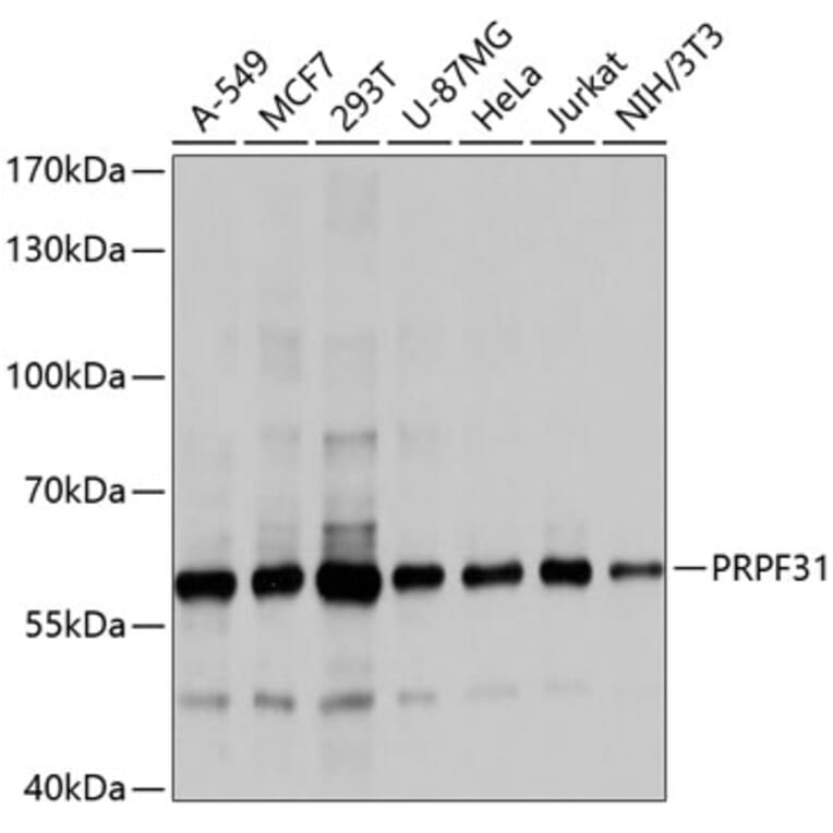 Western Blot - Anti-PRPF31 Antibody (A10920) - Antibodies.com