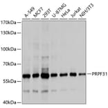 Western Blot - Anti-PRPF31 Antibody (A10920) - Antibodies.com
