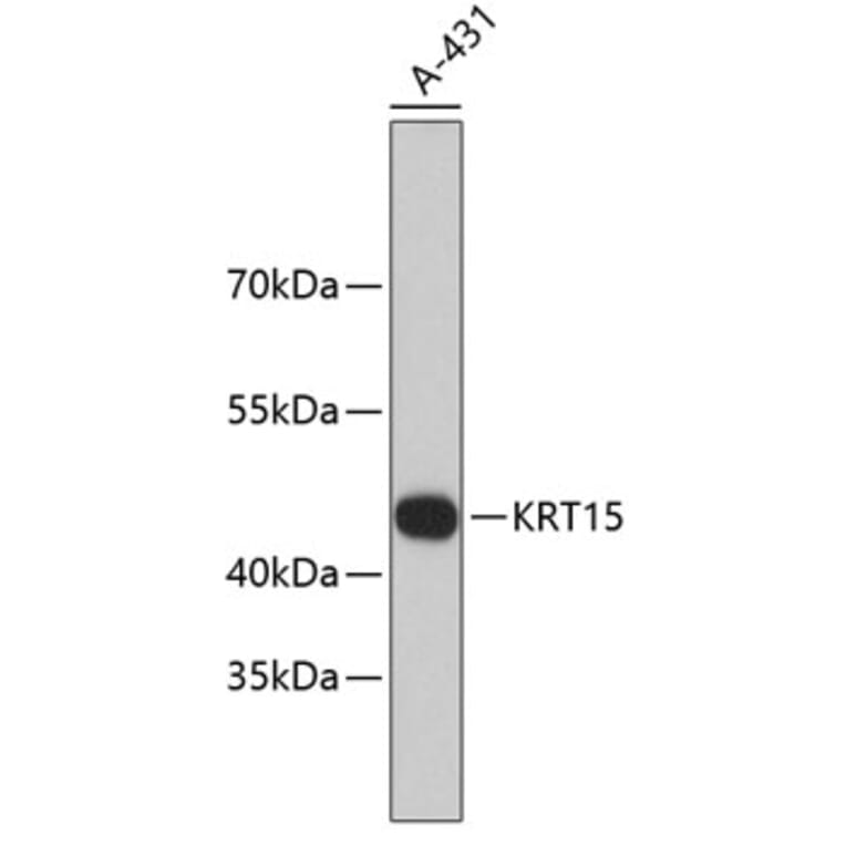 Western Blot - Anti-KRT15 Antibody (A10939) - Antibodies.com