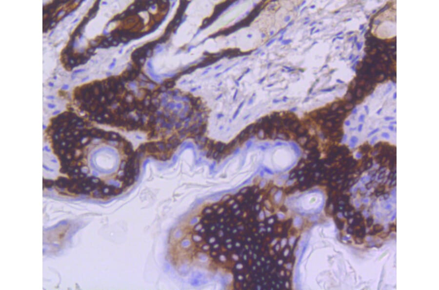Immunohistochemistry - Anti-KRT15 Antibody (A10939) - Antibodies.com