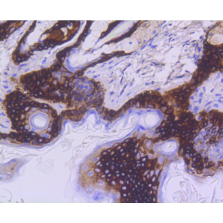 Immunohistochemistry - Anti-KRT15 Antibody (A10939) - Antibodies.com