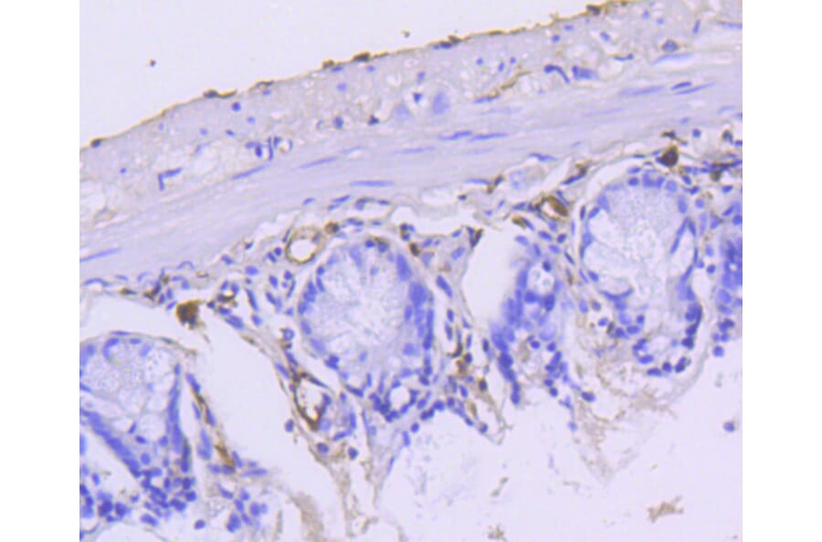 Immunohistochemistry - Anti-KRT15 Antibody (A10939) - Antibodies.com