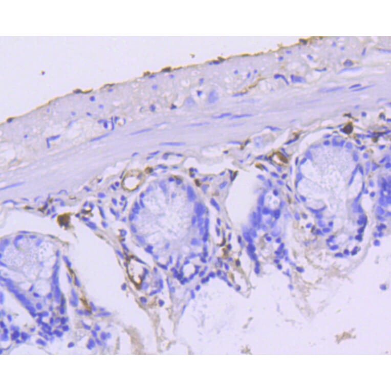 Immunohistochemistry - Anti-KRT15 Antibody (A10939) - Antibodies.com