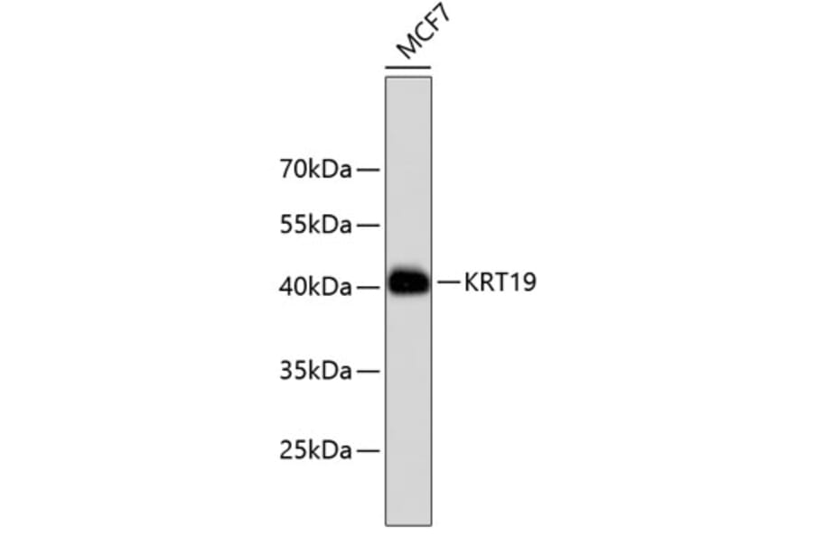 Western Blot - Anti-KRT19 Antibody (A10948) - Antibodies.com