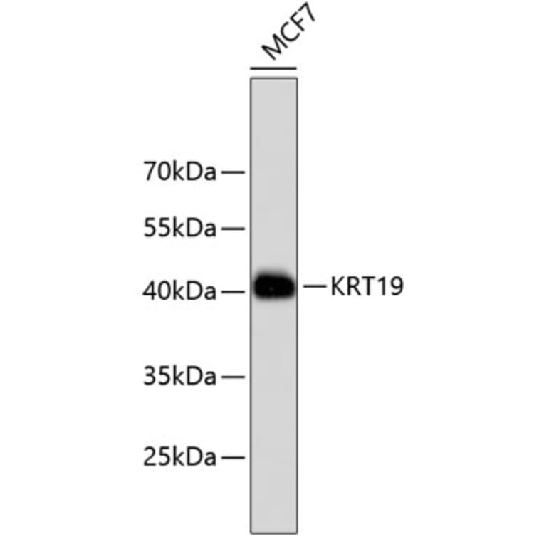 Western Blot - Anti-KRT19 Antibody (A10948) - Antibodies.com