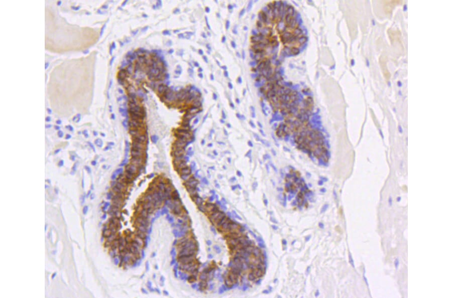 Immunohistochemistry - Anti-KRT19 Antibody (A10948) - Antibodies.com