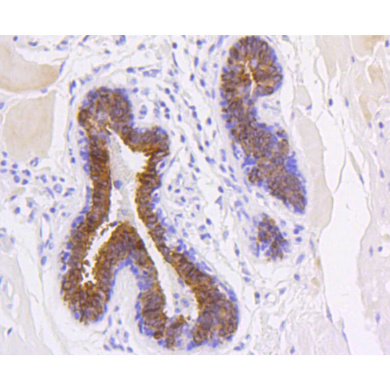 Immunohistochemistry - Anti-KRT19 Antibody (A10948) - Antibodies.com