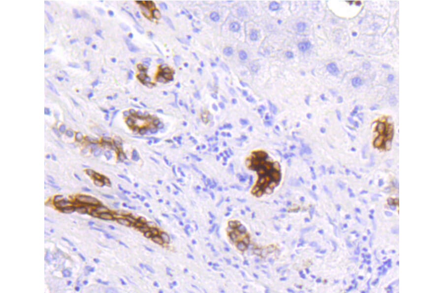 Immunohistochemistry - Anti-KRT19 Antibody (A10948) - Antibodies.com