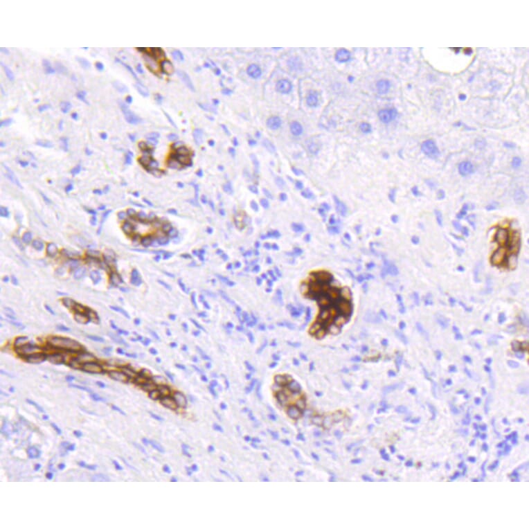 Immunohistochemistry - Anti-KRT19 Antibody (A10948) - Antibodies.com