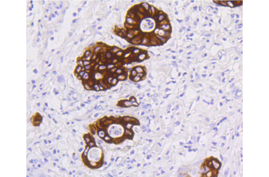 Immunohistochemistry - Anti-KRT19 Antibody (A10948) - Antibodies.com