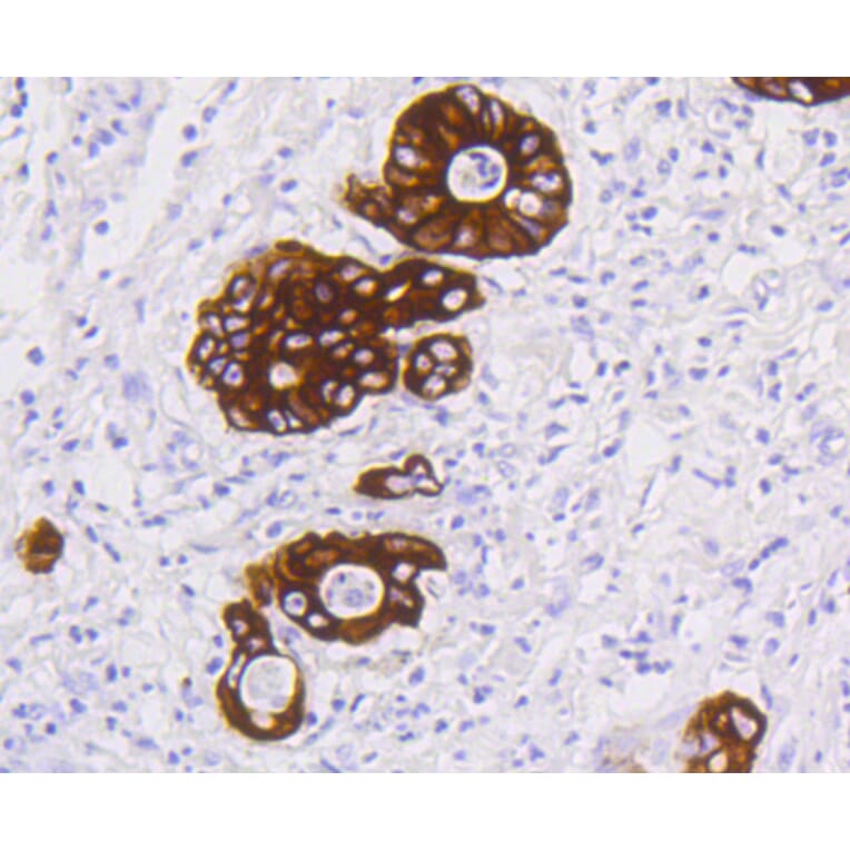 Immunohistochemistry - Anti-KRT19 Antibody (A10948) - Antibodies.com