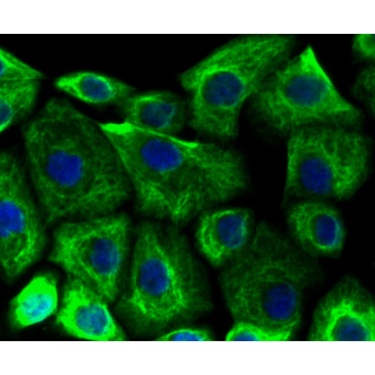 Immunofluorescence - Anti-KRT19 Antibody (A10948) - Antibodies.com