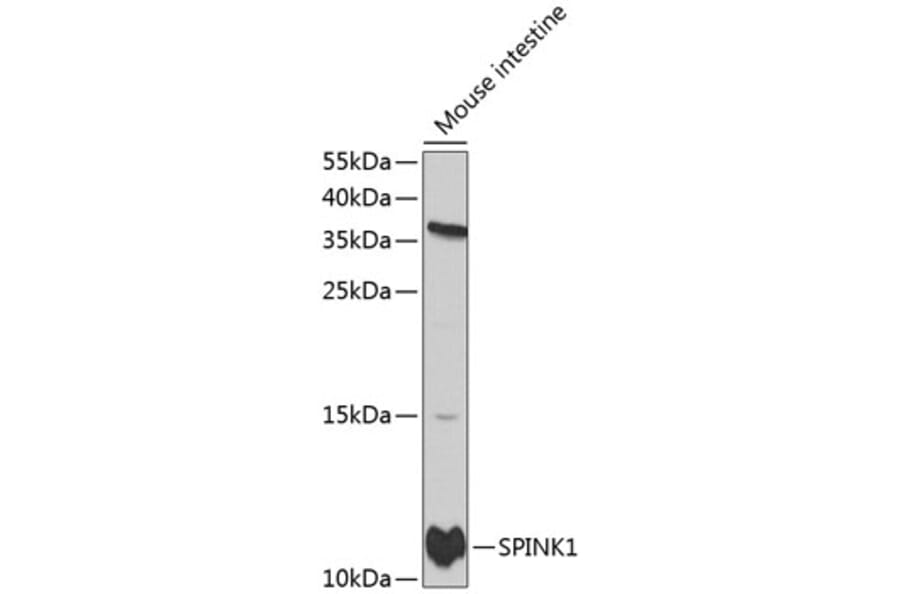 Western Blot - Anti-SPINK1/P12 Antibody (A11381) - Antibodies.com