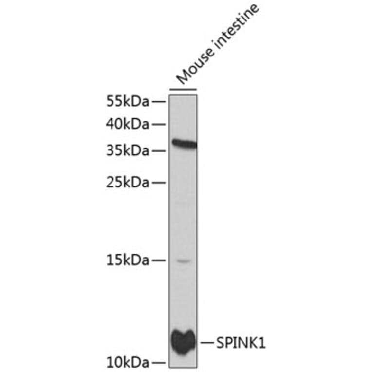 Western Blot - Anti-SPINK1/P12 Antibody (A11381) - Antibodies.com