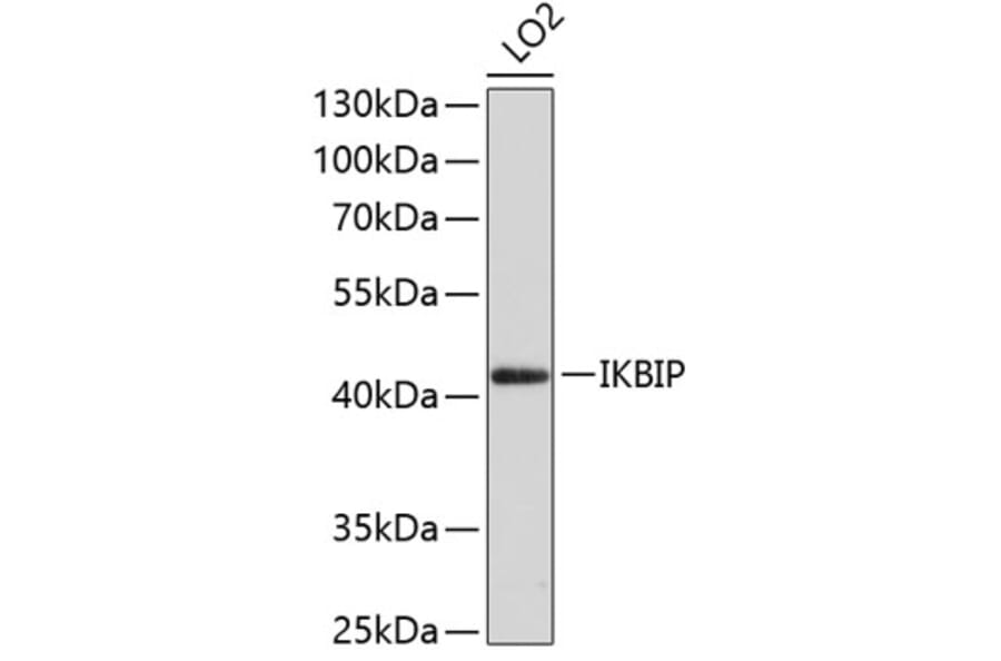 Western Blot - Anti-IKBIP Antibody (A10962) - Antibodies.com