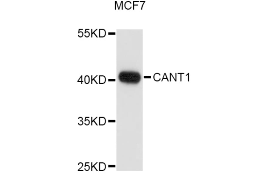 Western Blot - Anti-CANT1 Antibody (A10965) - Antibodies.com