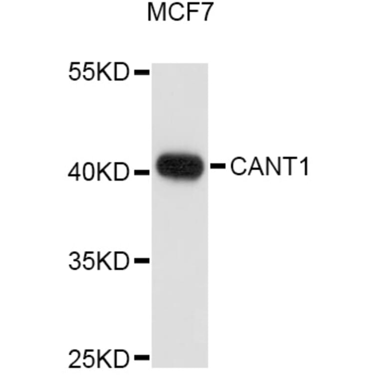 Western Blot - Anti-CANT1 Antibody (A10965) - Antibodies.com