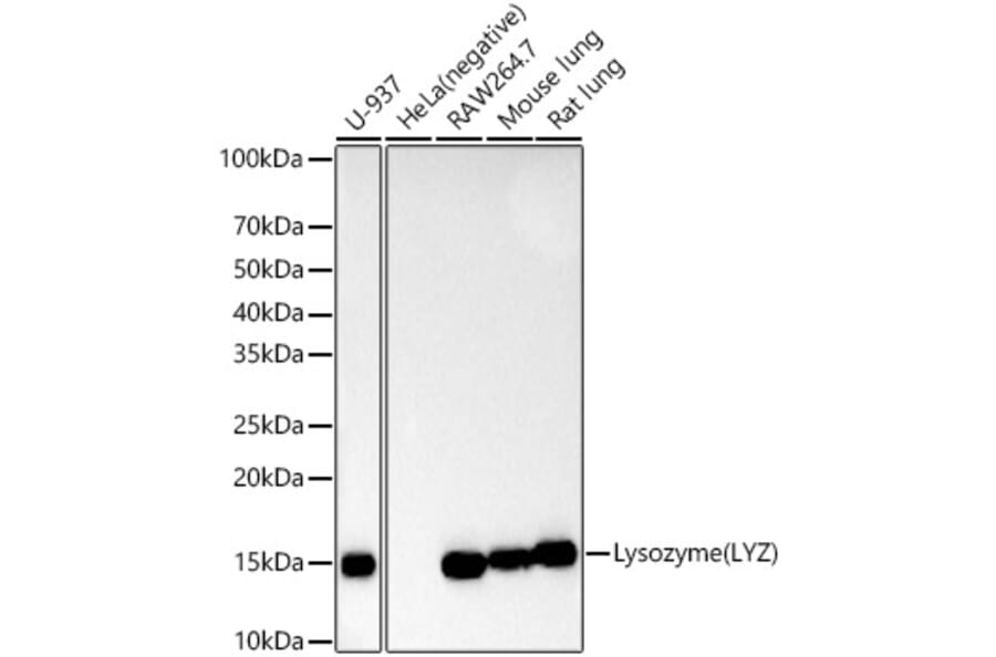Western Blot - Anti-Lysozyme Antibody [ARC57153] (A11385) - Antibodies.com