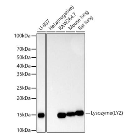 Western Blot - Anti-Lysozyme Antibody [ARC57153] (A11385) - Antibodies.com