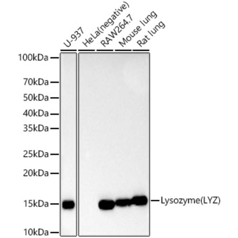 Western Blot - Anti-Lysozyme Antibody [ARC57153] (A11385) - Antibodies.com